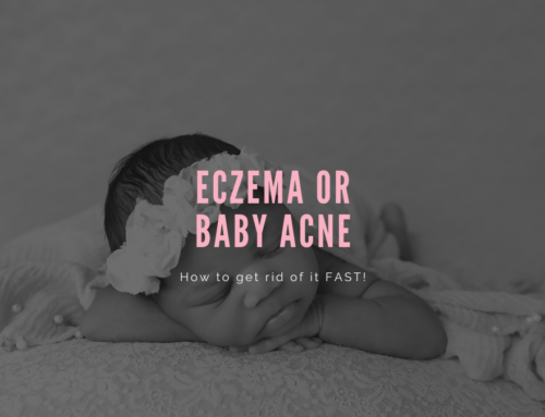 Eczema or Baby Acne- How to get rid of it FAST!